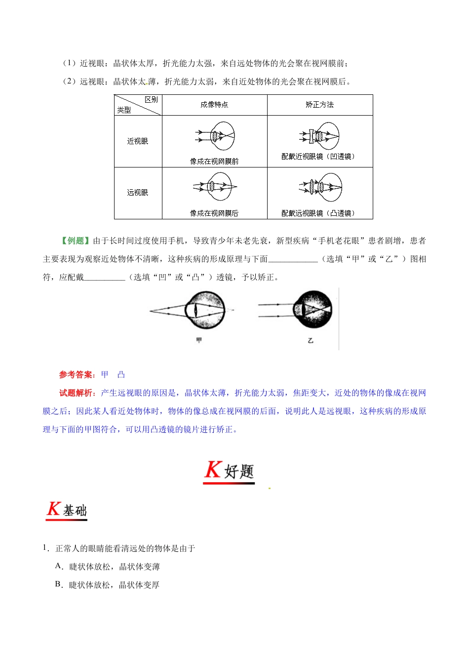 初二物理上册-专题5.4 眼睛和眼镜-初中物理同步讲义.docx_第3页